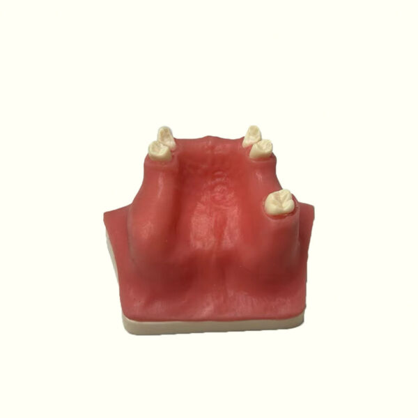 MẪU HÀM THỰC HÀNH NÂNG XOANG - Hình ảnh 2