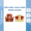 MẪU HÀM THỰC HÀNH NÂNG XOANG